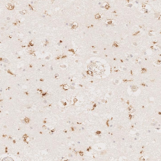 IHC staining of human brain using 66827-1-Ig