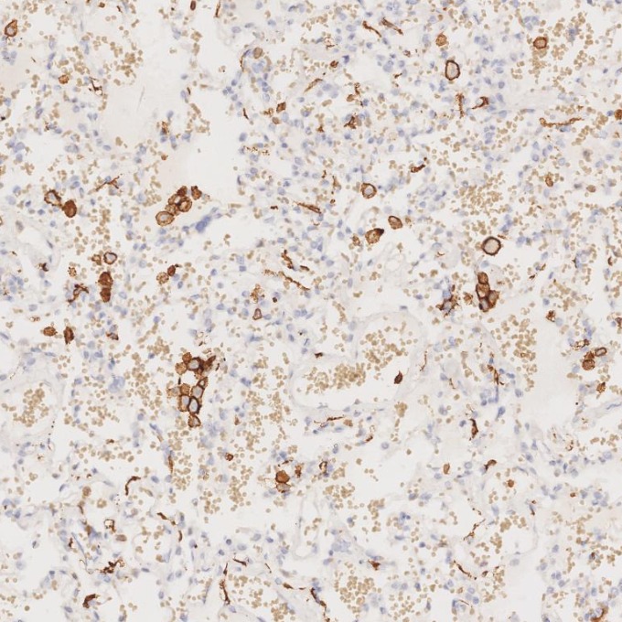 IHC staining of human lung using 66827-1-Ig