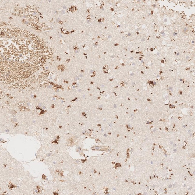IHC staining of human brain using 66827-1-Ig