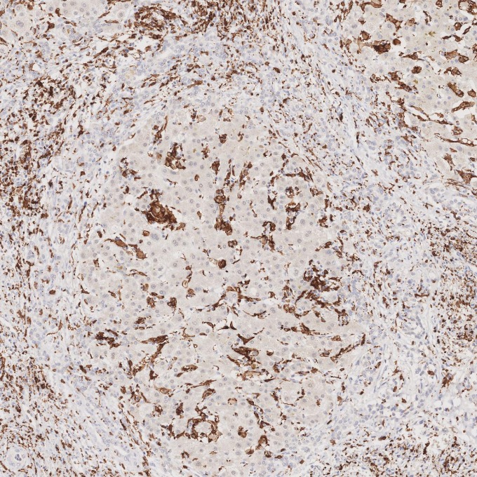 IHC staining of human liver using 66827-1-Ig