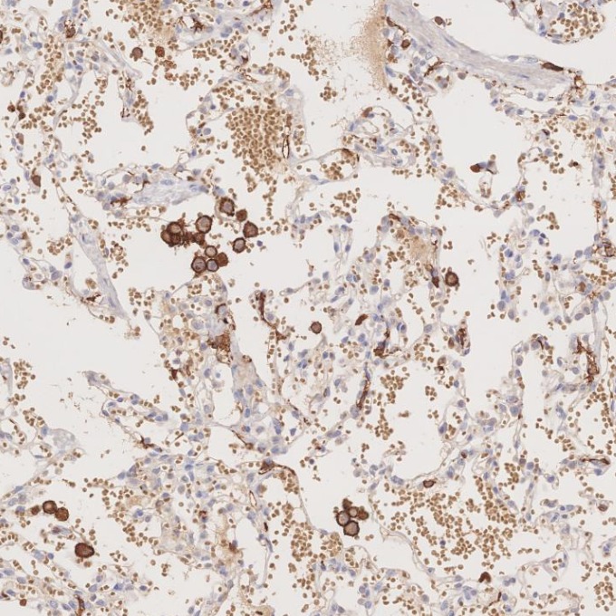 IHC staining of human lung using 66827-1-Ig