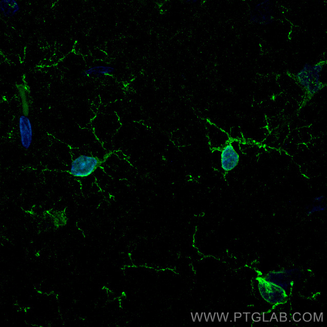 IF Staining of rat brain using 81728-1-RR