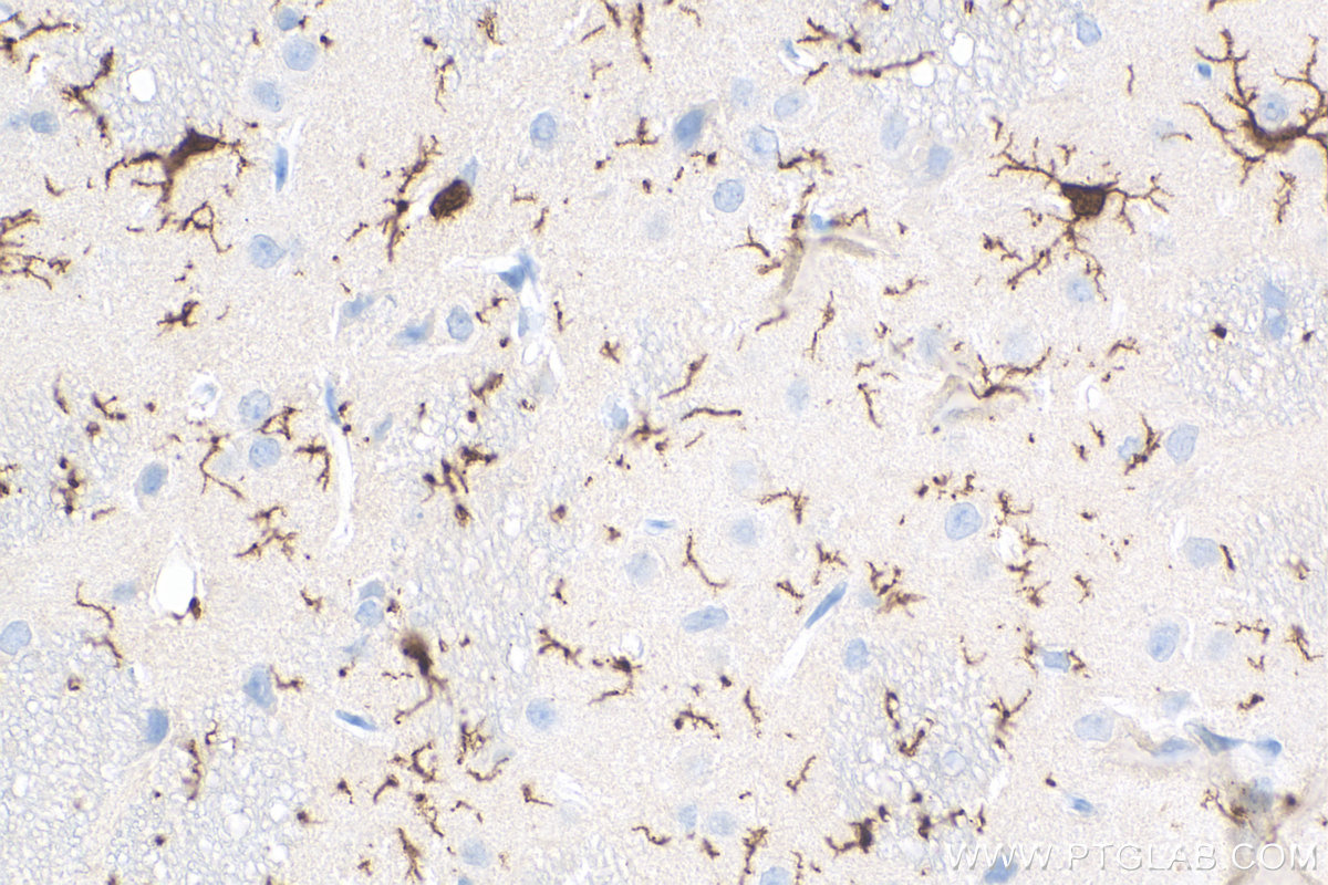 IHC staining of rat brain using 81728-1-RR (same clone as 81728-1-PBS)