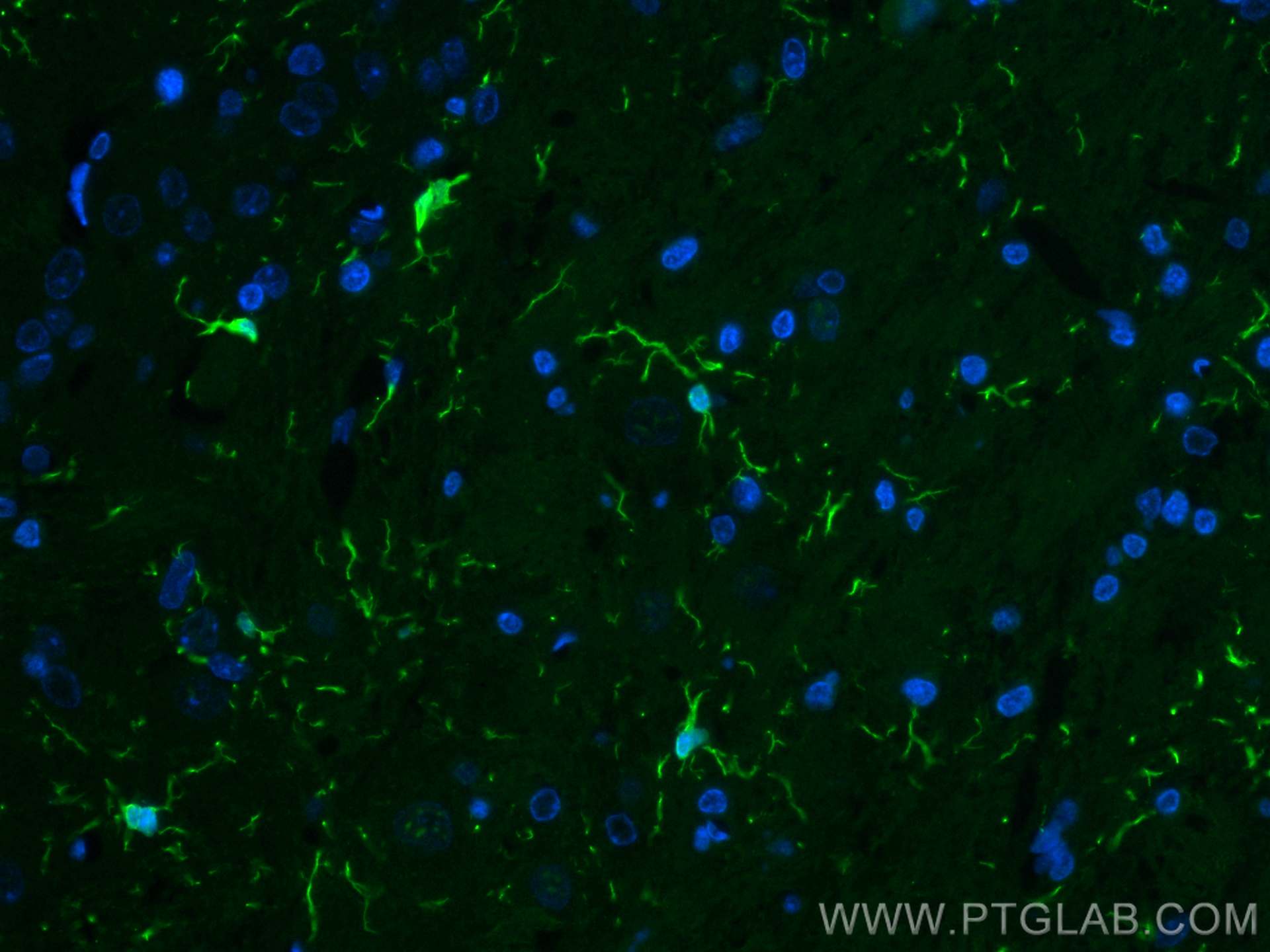 IF Staining of rat brain using CL488-10904