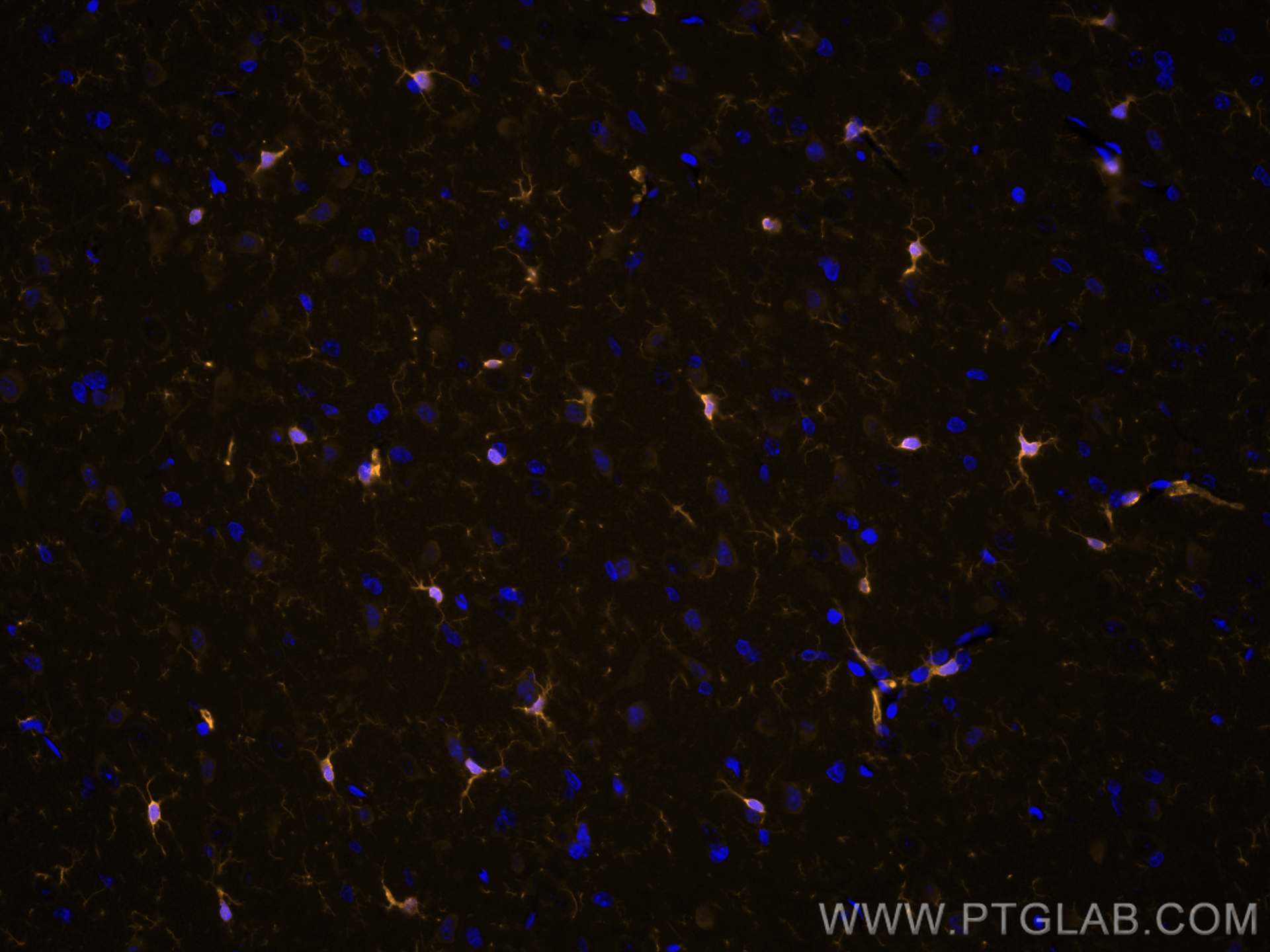 IF Staining of rat brain using CL555-81728