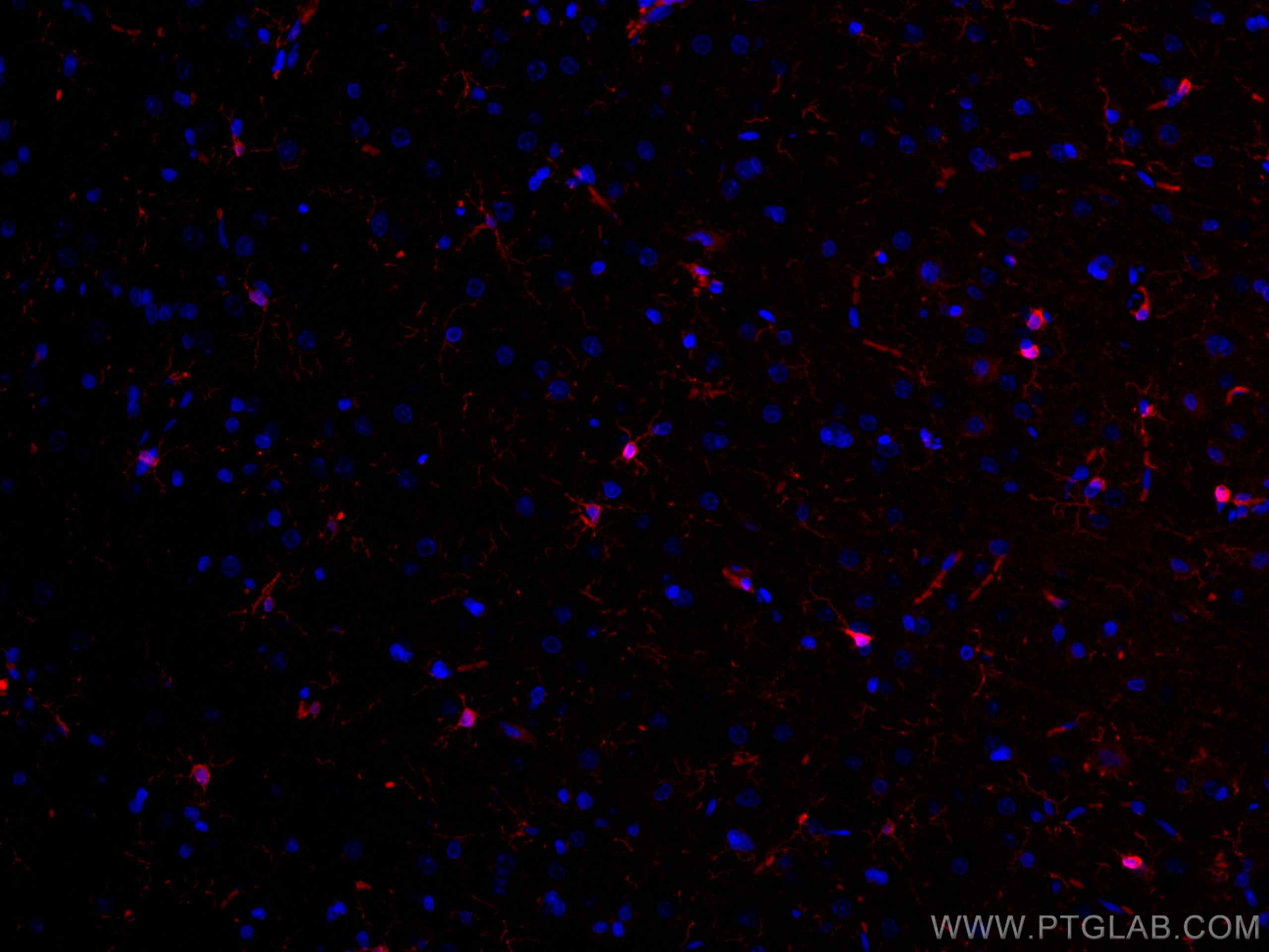 IF Staining of rat brain using CL594-10904