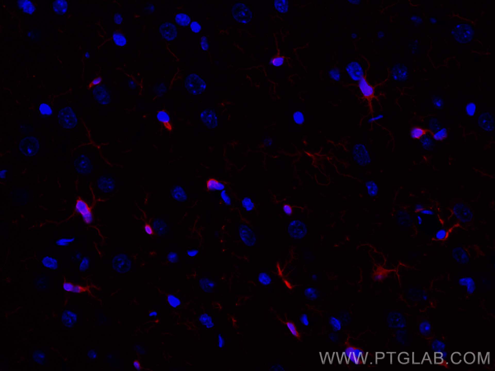 IF Staining of rat brain using CL594-81728