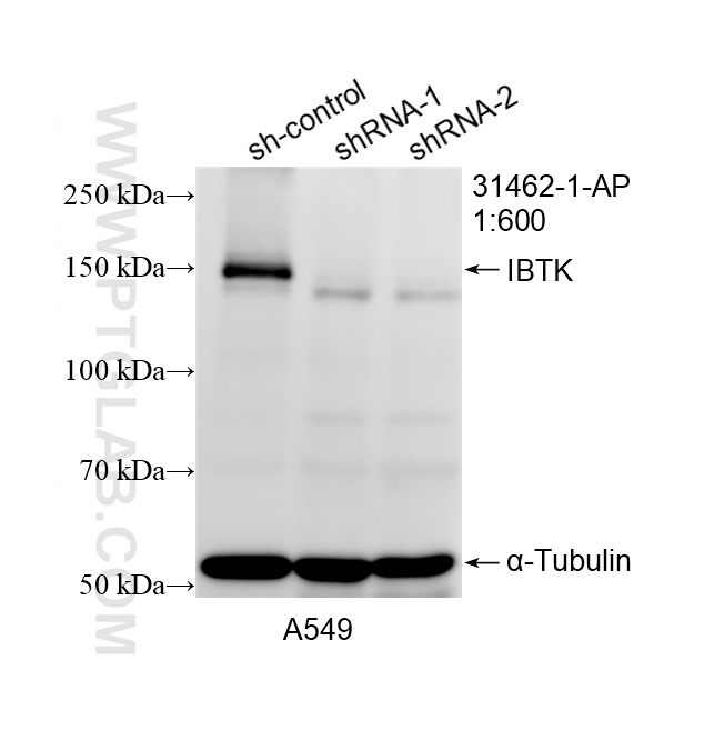 WB result of IBTK antibody (31462-1-AP; 1:600; incubated at room temperature for 1.5 hours) with sh-Control and sh-IBTK transfected A549 cells. WB analysis of A549 using 31462-1-AP