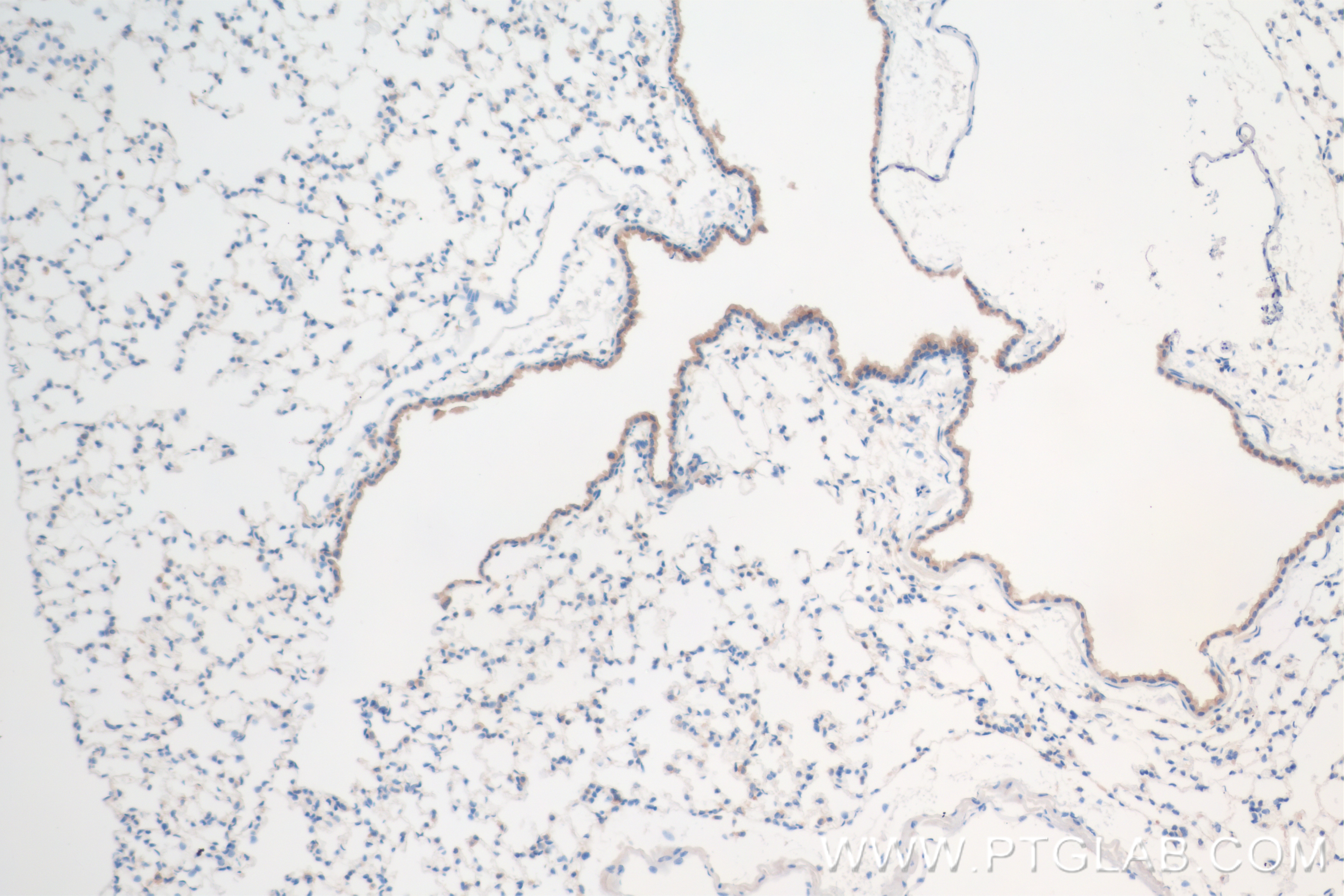 IHC staining of mouse lung using 84706-4-RR