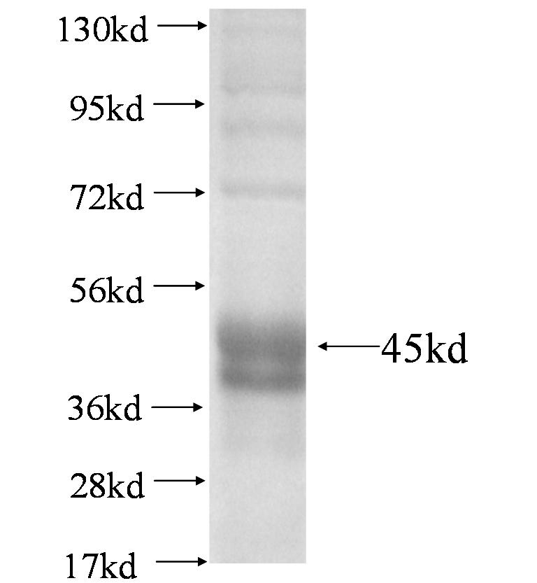 ICA1 fusion protein Ag4372 SDS-PAGE ICA1 fusion protein Ag4372 SDS-PAGE