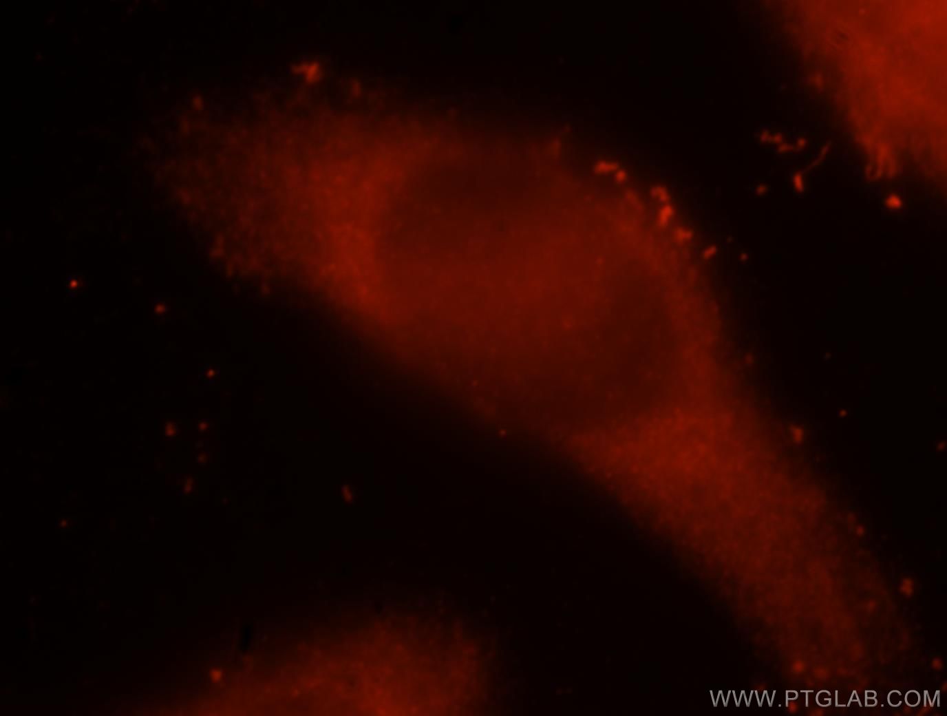 IF Staining of MCF-7 using 15622-1-AP