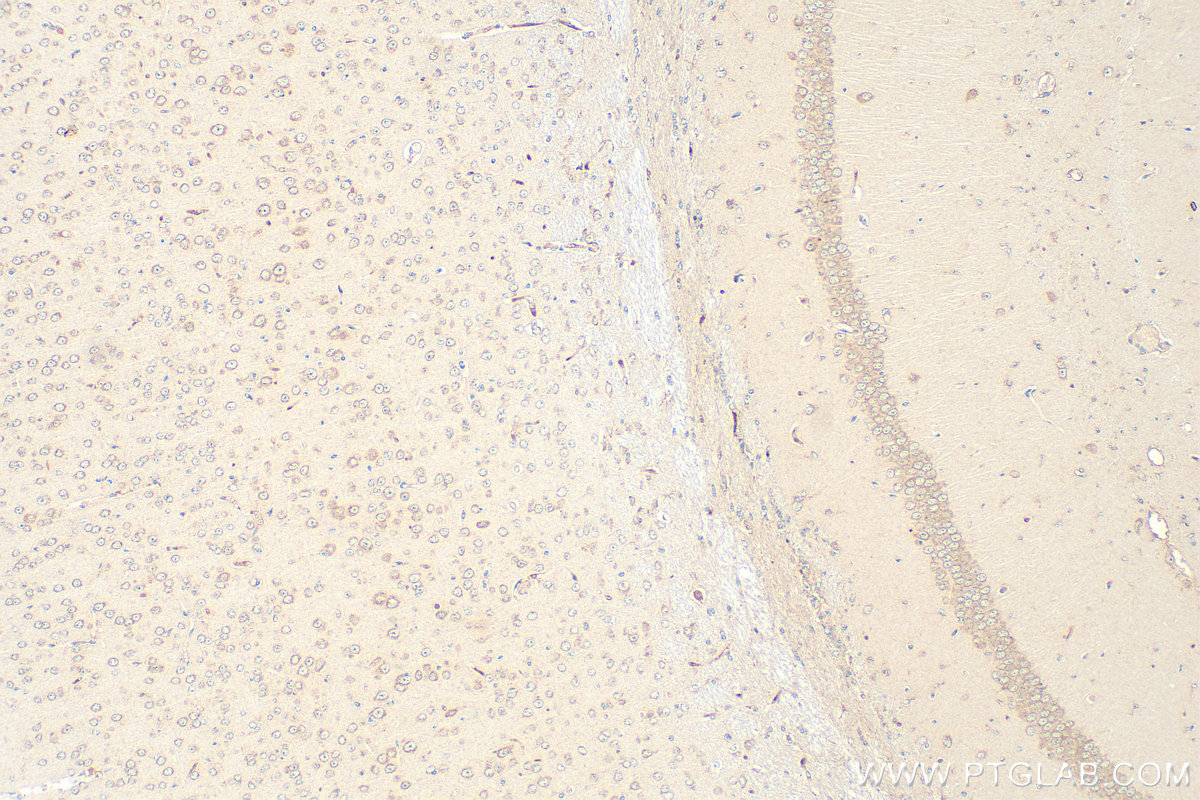 Immunohistochemical analysis of paraffin-embedded mouse brain tissue slide using 18021-1-AP (ICA1L antibody) at dilution of 1:200 (under 10x lens). Heat mediated antigen retrieval with Tris-EDTA buffer (pH 9.0). IHC staining of mouse brain using 18021-1-AP