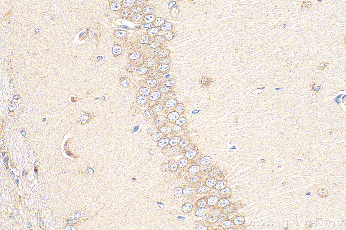 Immunohistochemical analysis of paraffin-embedded mouse brain tissue slide using 18021-1-AP (ICA1L antibody) at dilution of 1:200 (under 40x lens). Heat mediated antigen retrieval with Tris-EDTA buffer (pH 9.0). IHC staining of mouse brain using 18021-1-AP