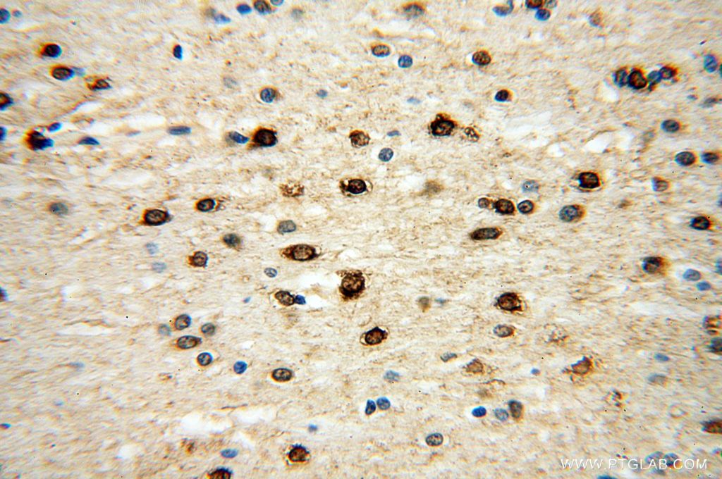 IHC staining of human brain using 18021-1-AP