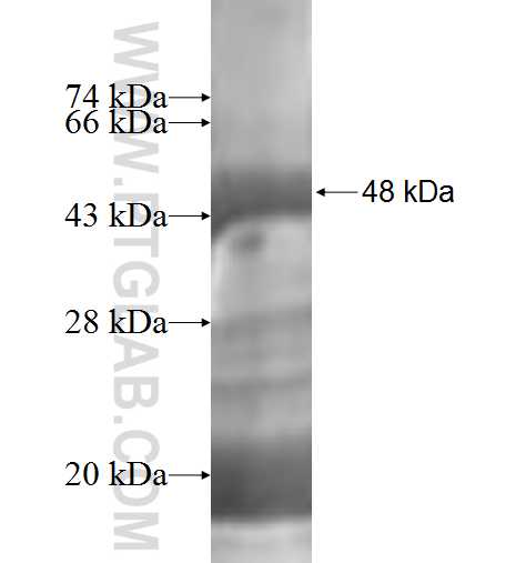 ICA1L fusion protein Ag2276 SDS-PAGE ICA1L fusion protein Ag2276 SDS-PAGE