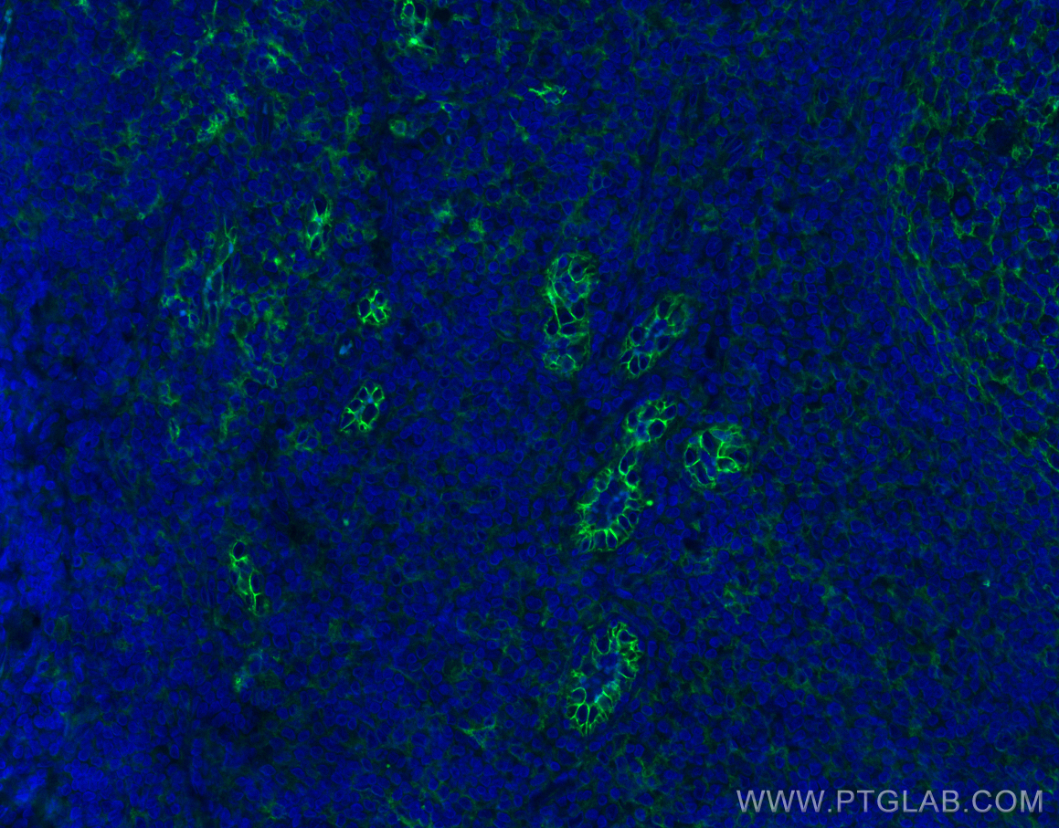 IF Staining of human tonsillitis using 10831-1-AP