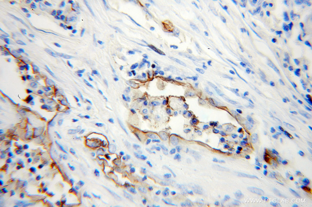 ICAM-1 Polyclonal antibody