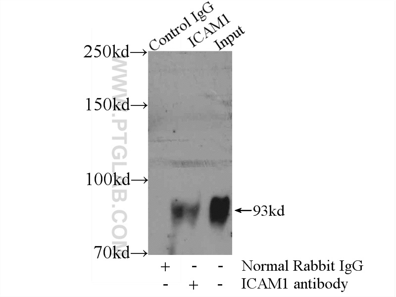 IP experiment of Raji using 10831-1-AP