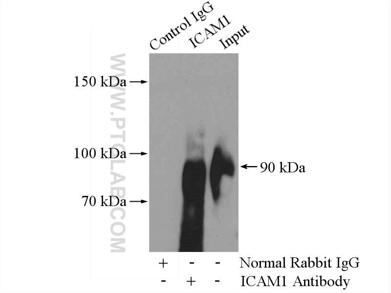 IP experiment of Raji using 15364-1-AP