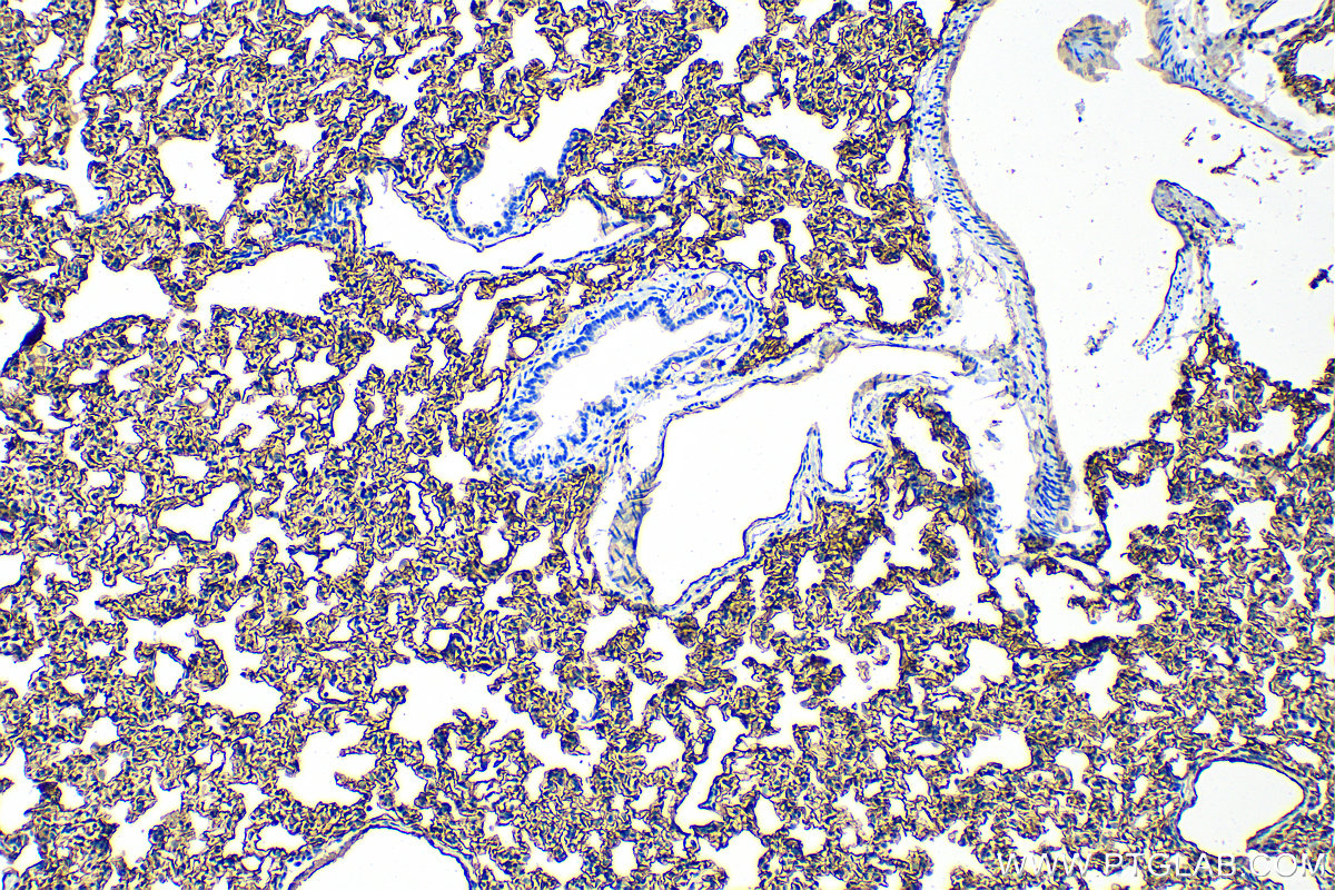 IHC staining of rat lung using 31451-1-AP