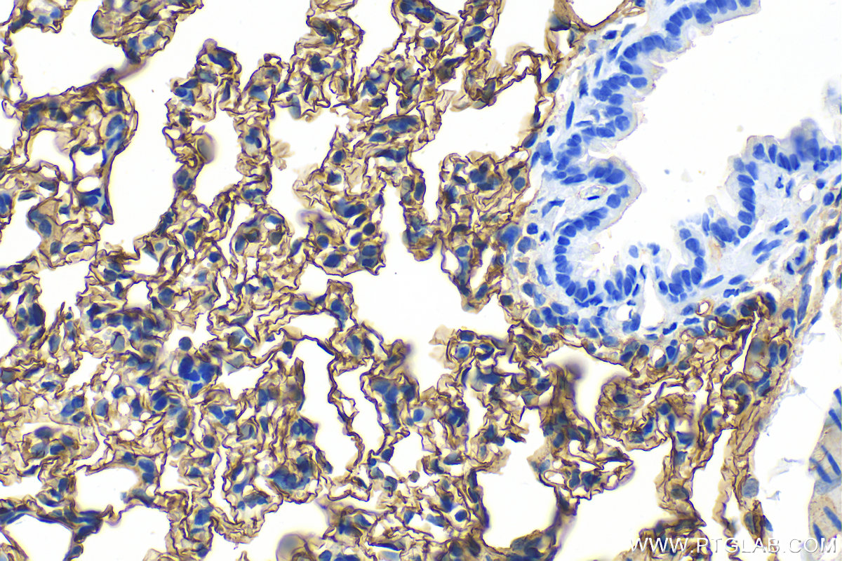 IHC staining of rat lung using 31451-1-AP