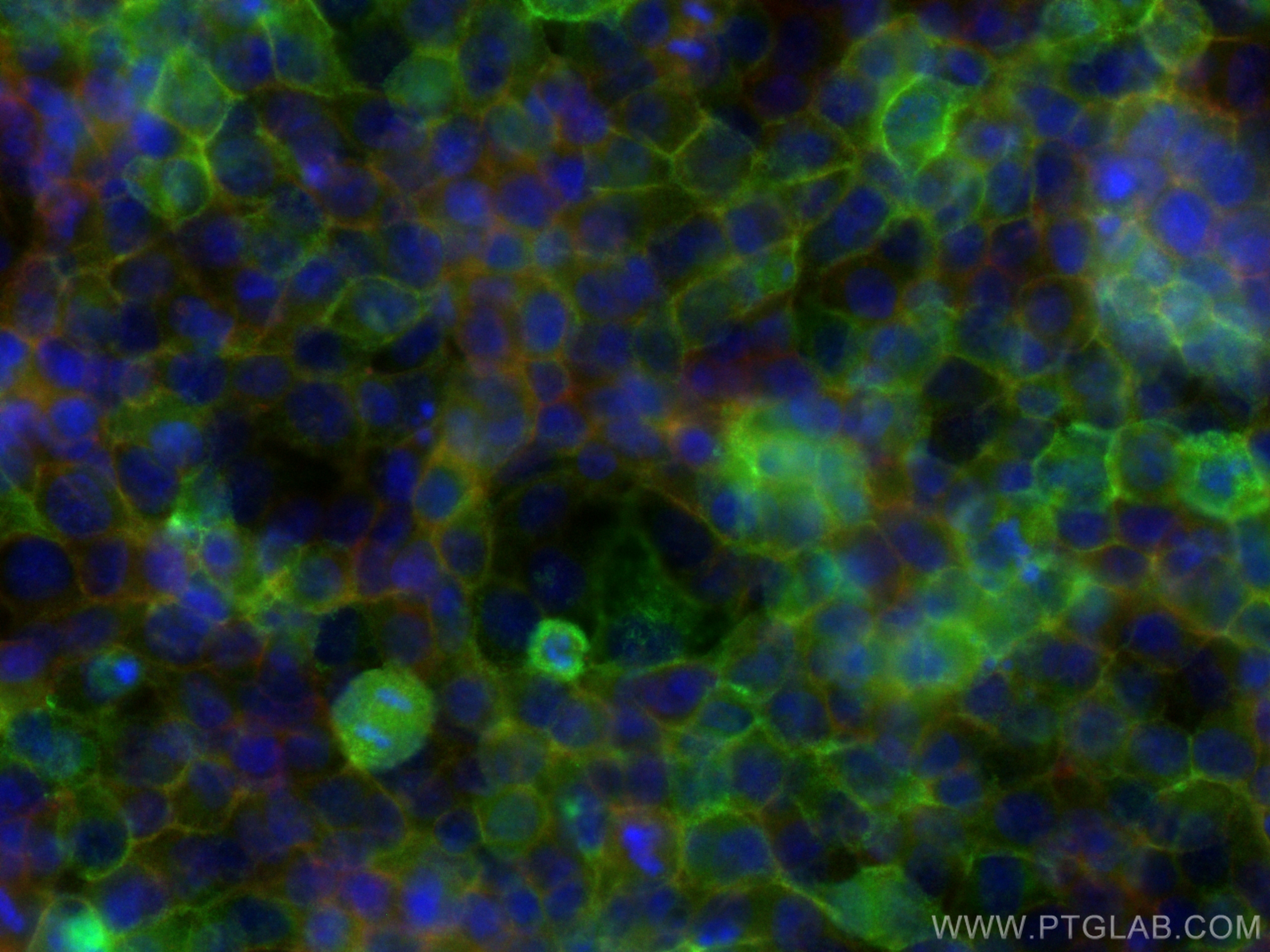 IF Staining of HeLa using 83069-6-RR (same clone as 83069-6-PBS)