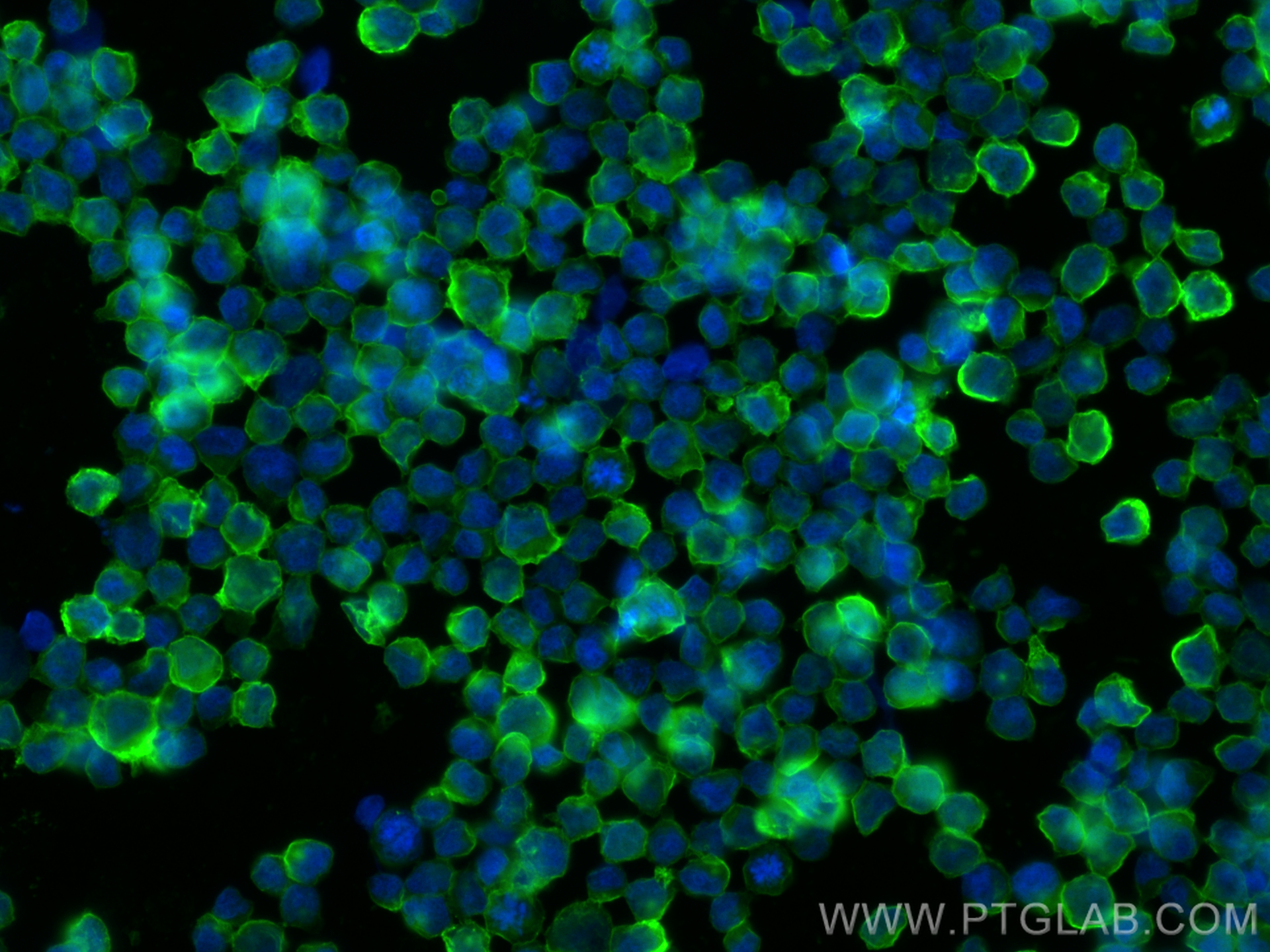 IF Staining of Raji using RMX00016
