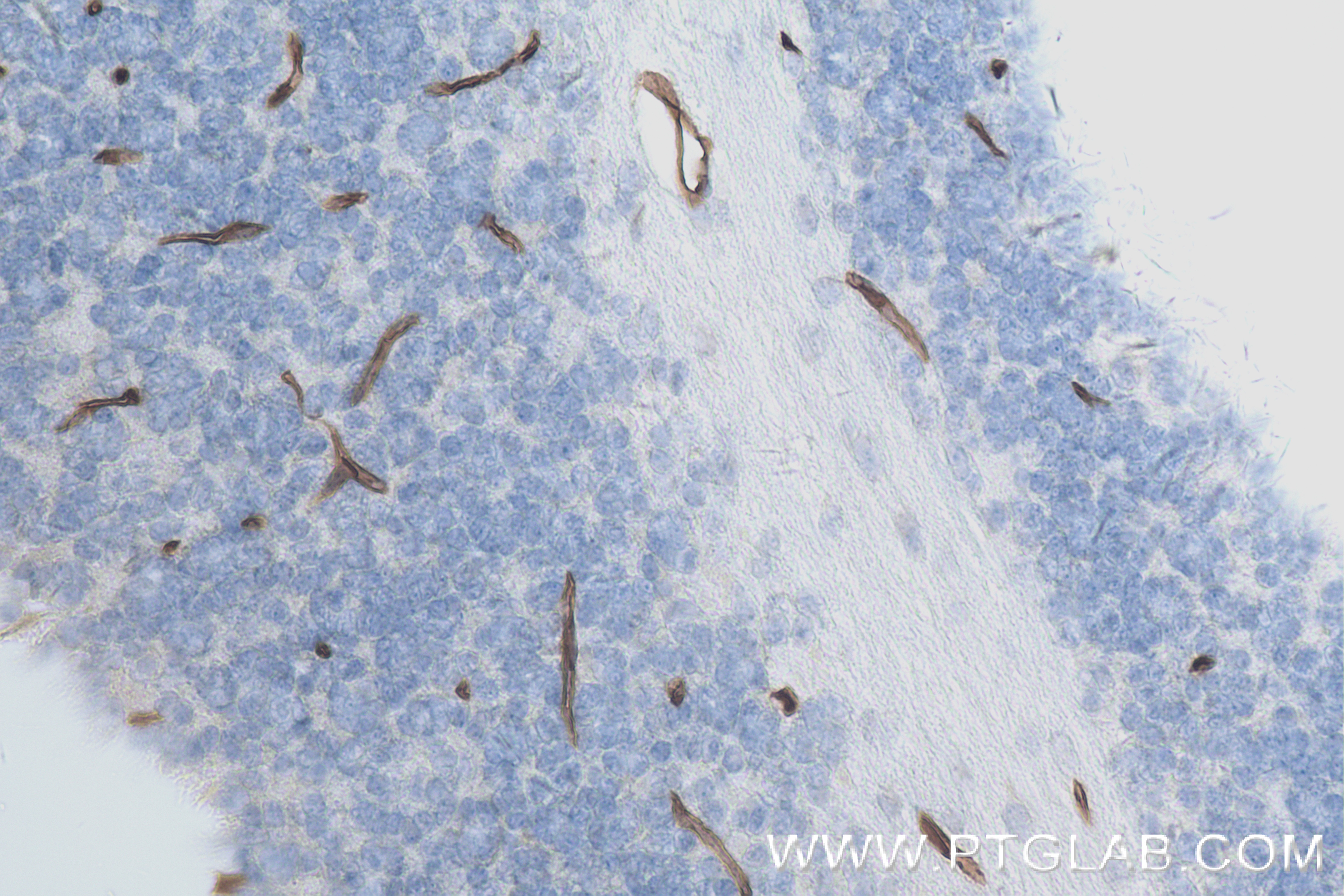 IHC staining of mouse cerebellum using 84442-1-RR