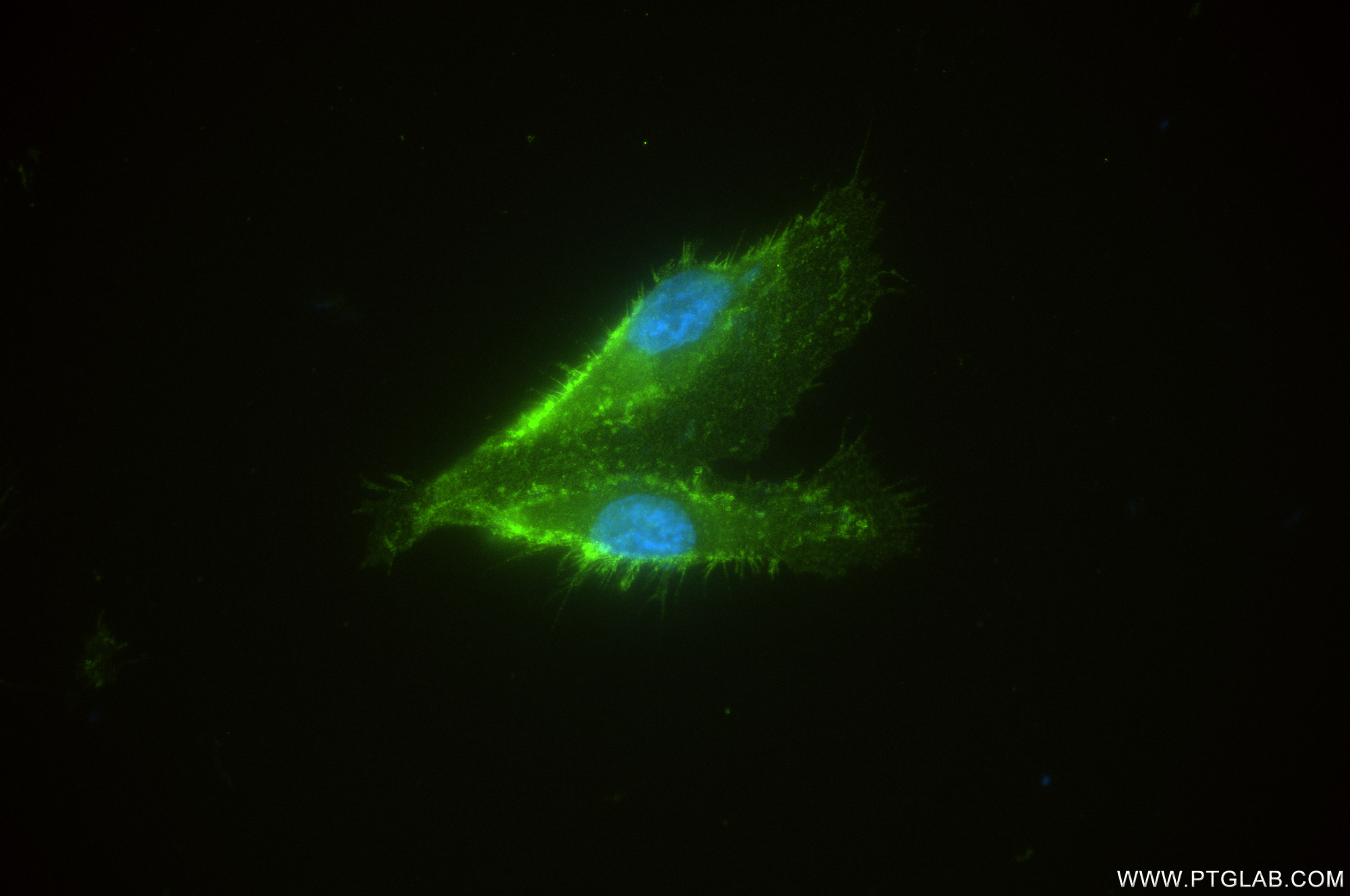IF Staining of HUVEC using 84857-2-RR
