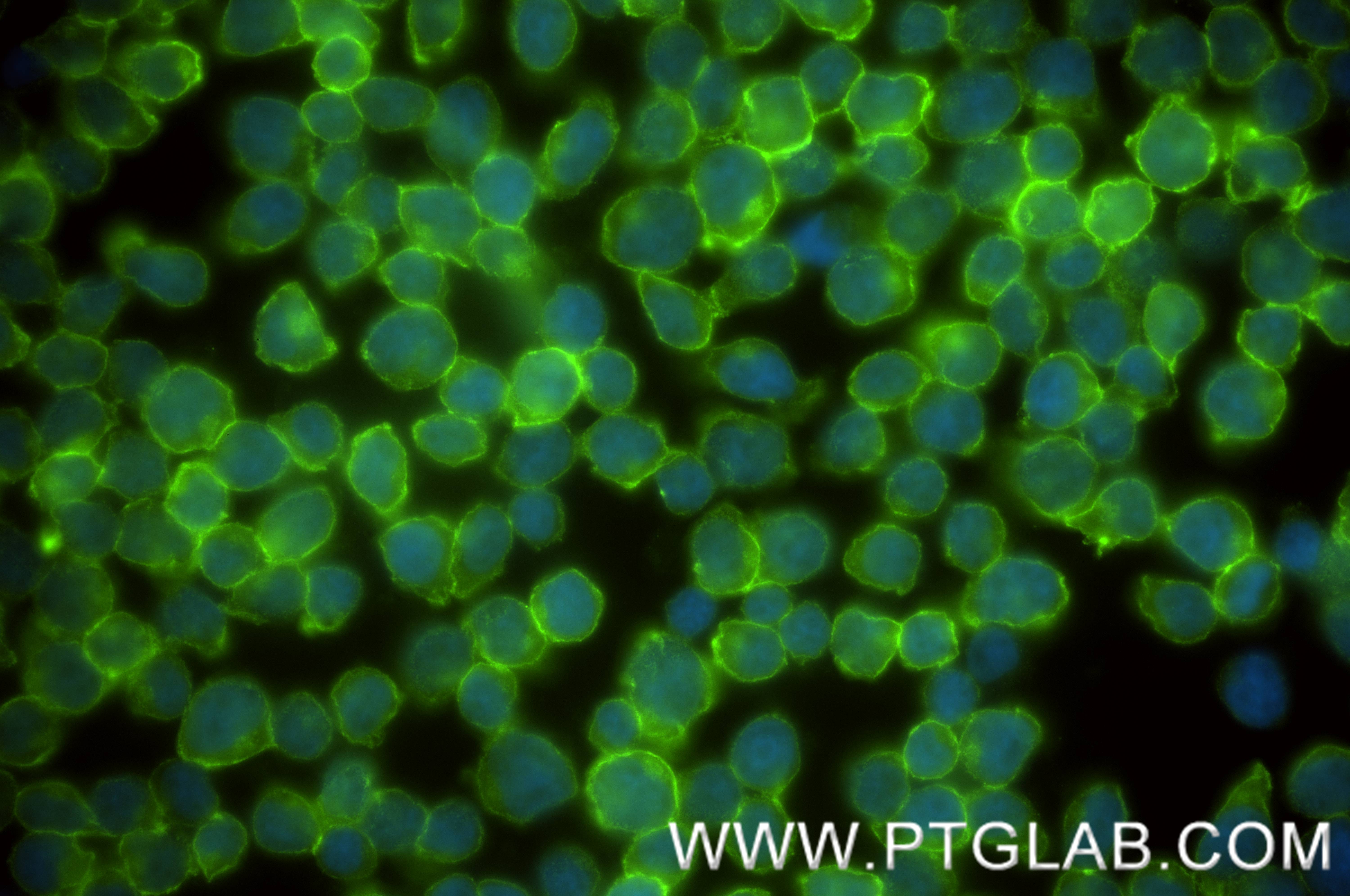 IF Staining of Jurkat using 84857-2-RR (same clone as 84857-2-PBS)
