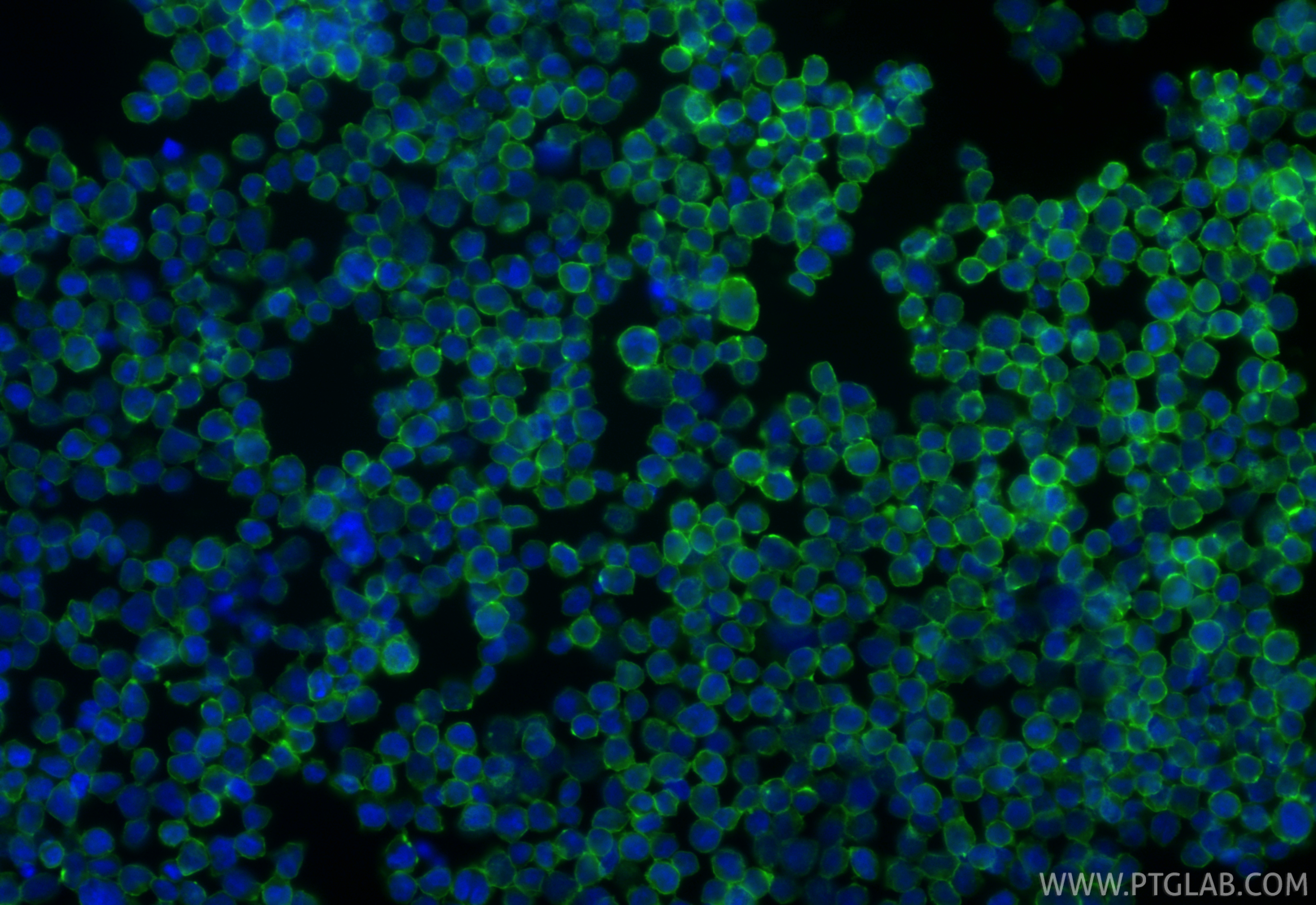 Immunofluorescent analysis of (4% PFA) fixed Jurkat cells using ICAM-2/CD102 antibody (<a class='green' href='/productredirect?CatalogNo=84857-3-RR' target='_blank'>84857-3-RR</a>, Clone: 242237G11 ) at dilution of 1:200 and CoraLite®488-Conjugated Goat Anti-Rabbit IgG(H+L) (<a class='green' href='/productredirect?CatalogNo=SA00013-2' target='_blank'>SA00013-2</a>). This data was developed using the same antibody clone with 84857-3-PBS in a different storage buffer formulation. IF Staining of Jurkat using 84857-3-RR (same clone as 84857-3-PBS)