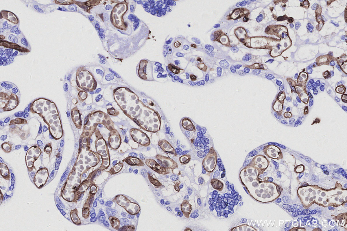 IHC staining of human placenta using 84857-3-RR IHC staining of human placenta using 84857-3-RR