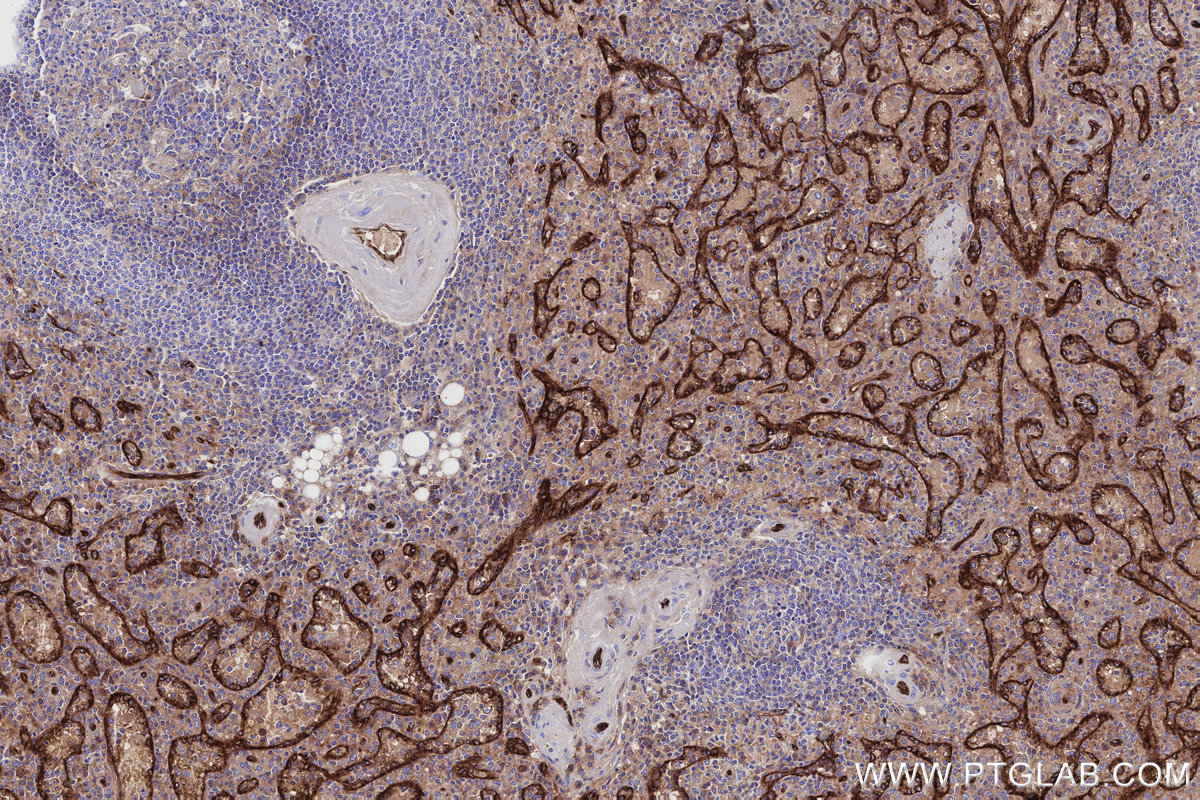 IHC staining of human spleen using 84857-3-RR IHC staining of human spleen using 84857-3-RR