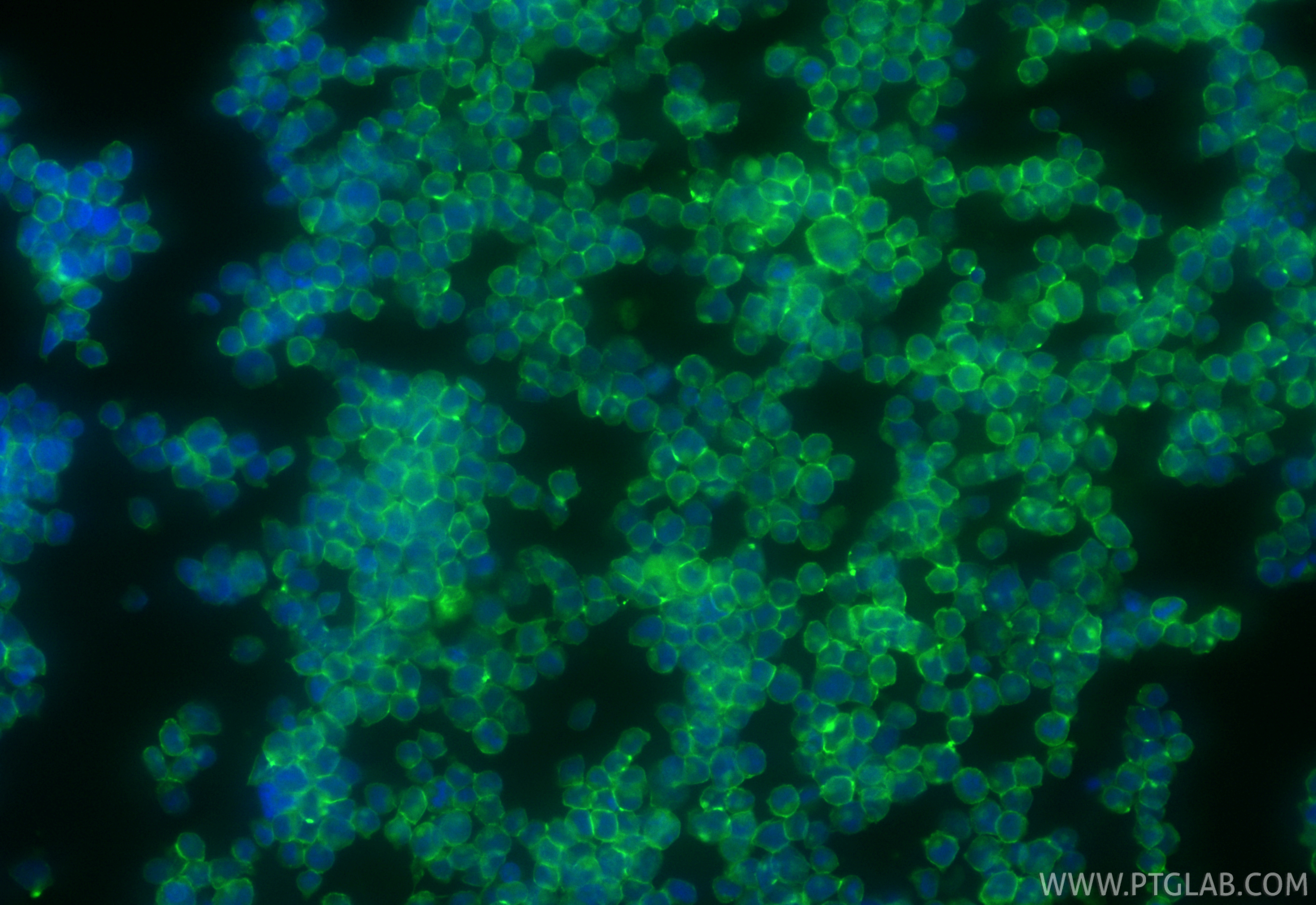 Immunofluorescent analysis of (4% PFA) fixed Jurkat cells using CoraLite® Plus 488 ICAM-2/CD102 antibody (CL488-84857-2, Clone: 242237F8 ) at dilution of 1:200. IF Staining of Jurkat using CL488-84857-2