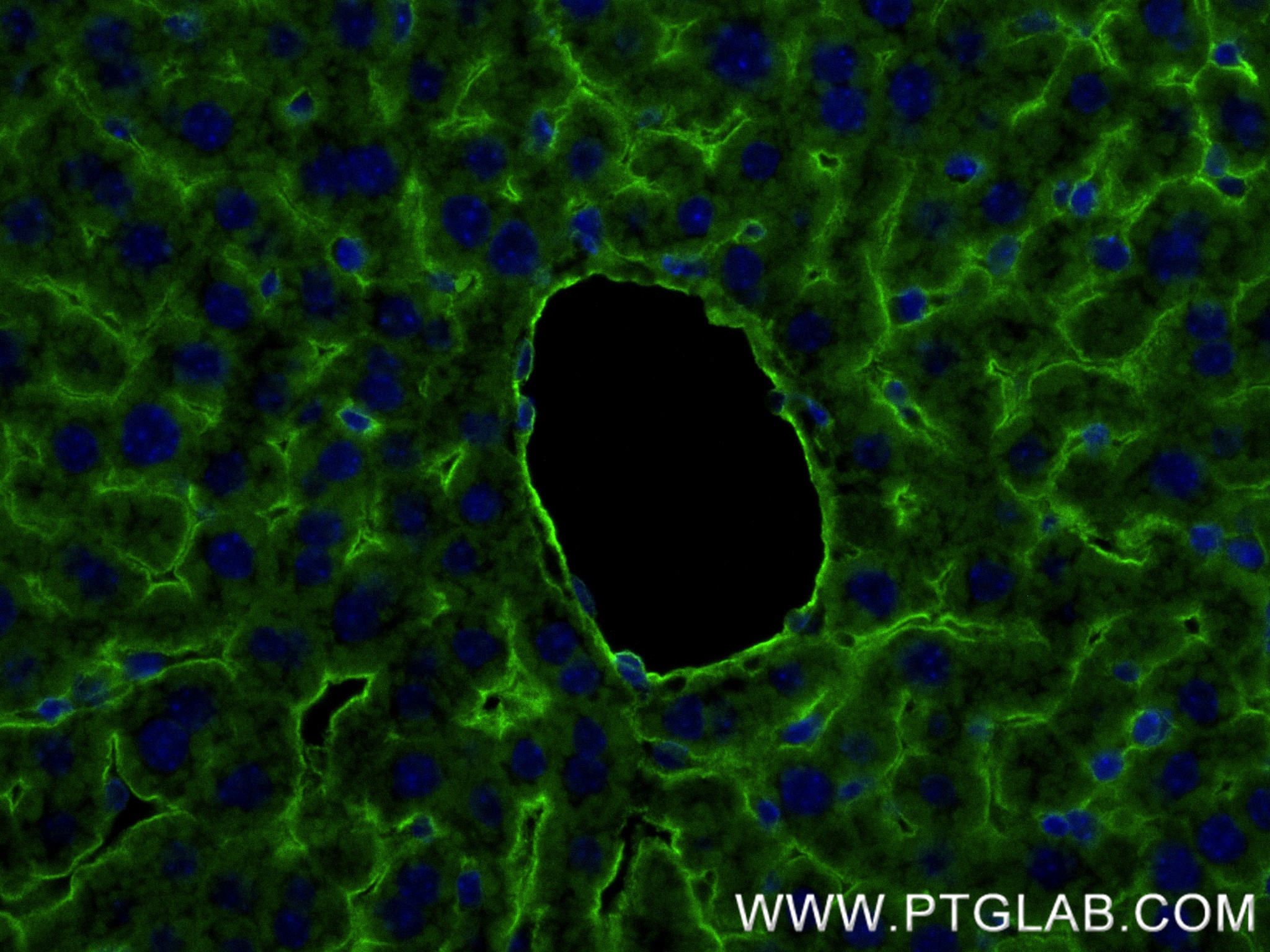 IF Staining of mouse liver using 82827-8-RR
