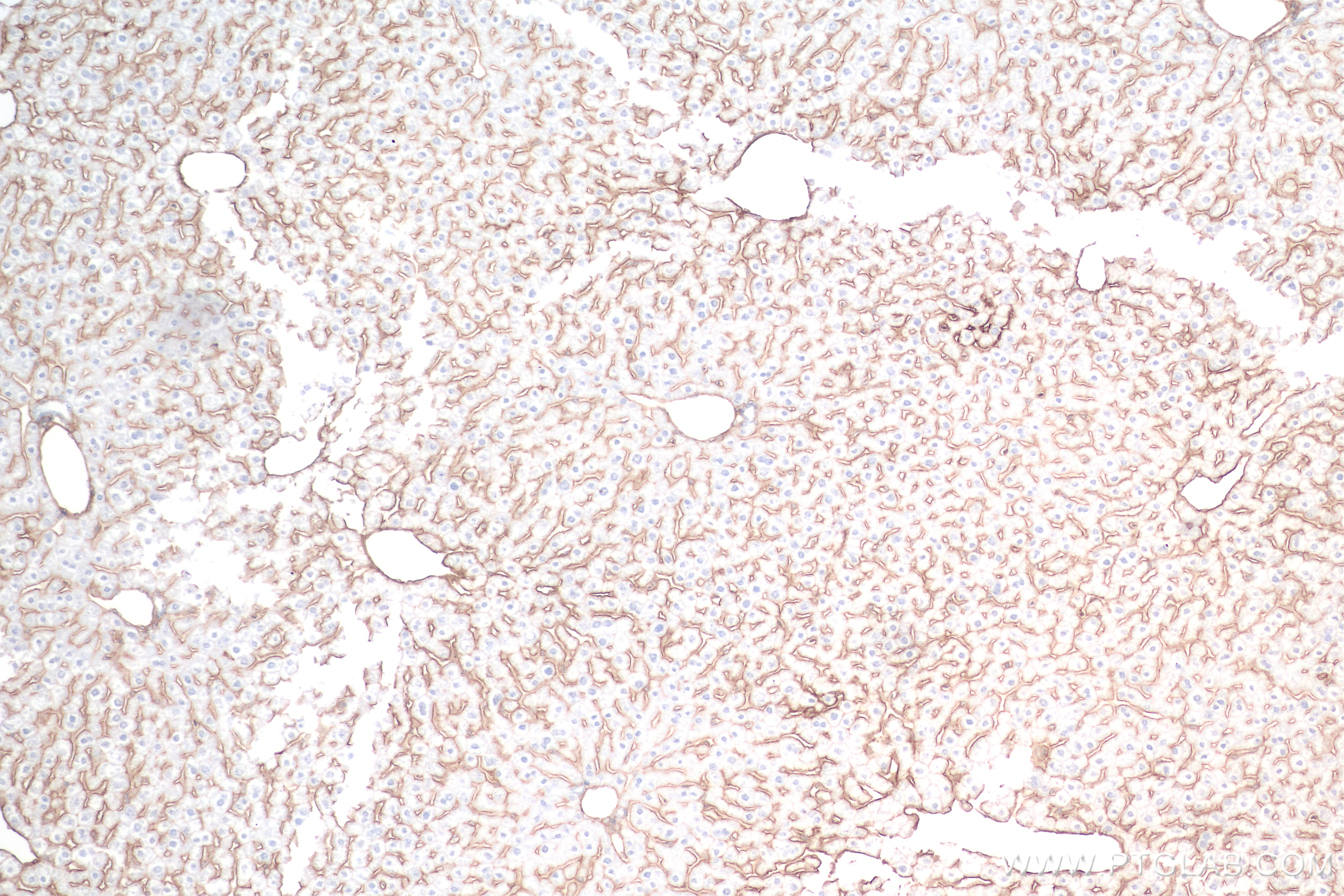 IHC staining of mouse liver using 82827-8-RR