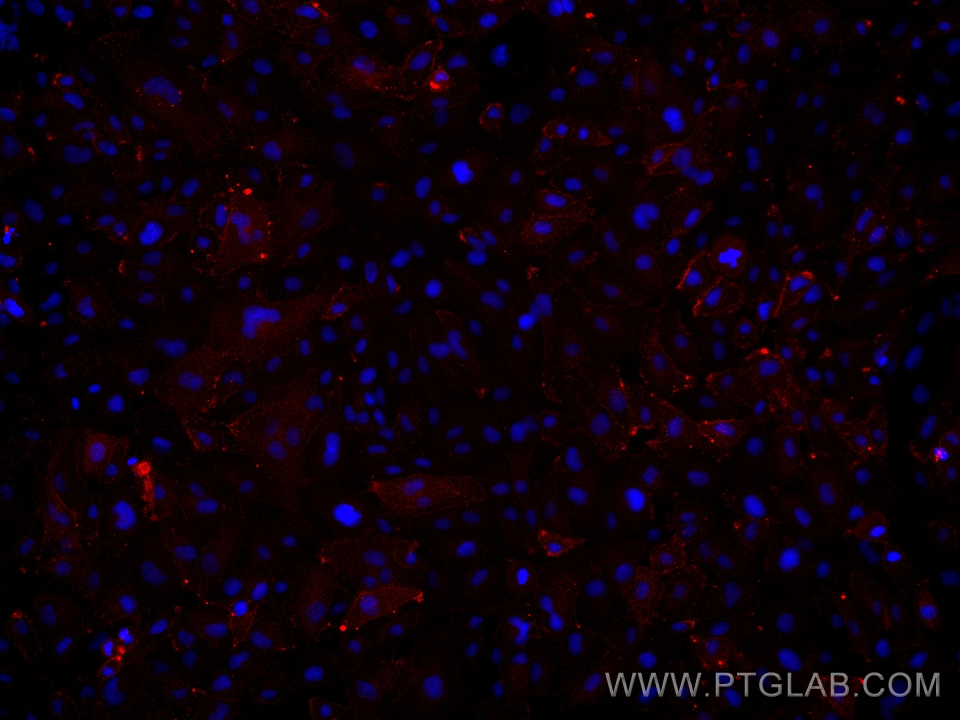 IF Staining of HUVEC using 67628-1-Ig (same clone as 67628-1-PBS)