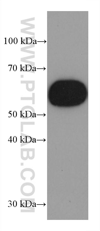 WB analysis of human peripheral blood platelets using 67628-1-Ig (same clone as 67628-1-PBS)