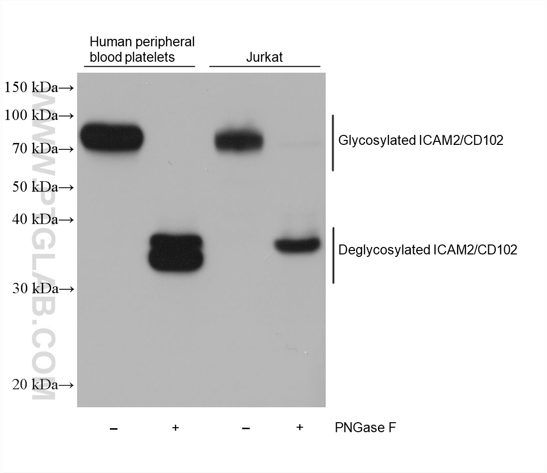 Untreated and PNGase F-treated lysates of human peripheral blood platelets and Jurkat cells were subjected to SDS PAGE followed by western blot with 67628-1-Ig (ICAM2/CD102 antibody) at dilution of 1:10000 incubated at room temperature for 1.5 hours. WB analysis using 67628-1-Ig