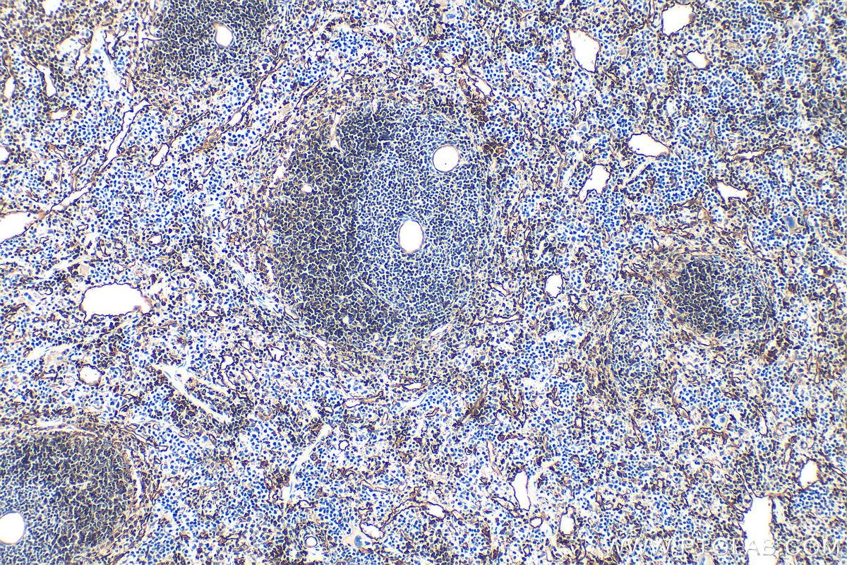 IHC staining of mouse spleen using 31950-1-AP