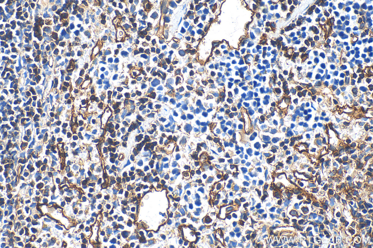 IHC staining of mouse spleen using 31950-1-AP