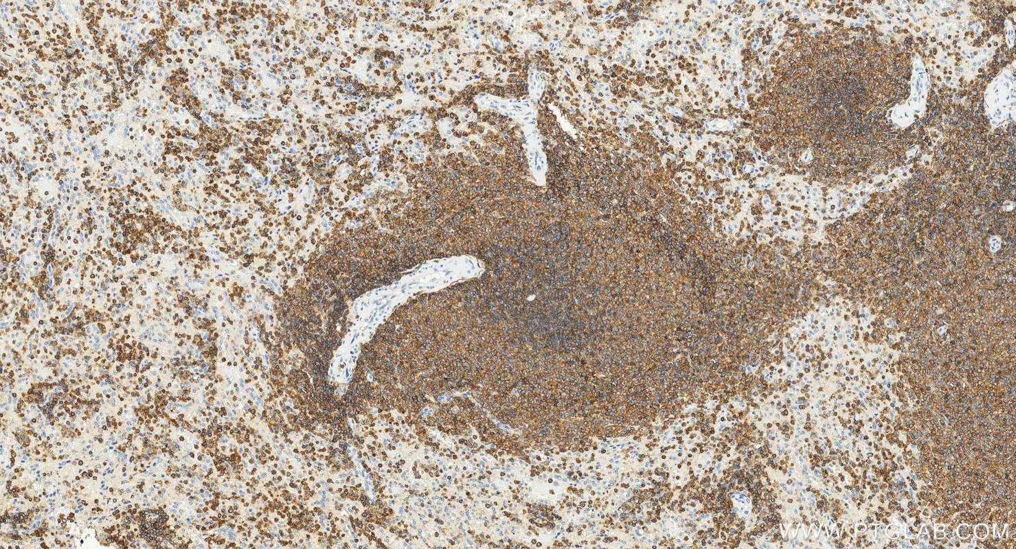 IHC staining of human spleen using 17699-1-AP (same clone as 17699-1-PBS)