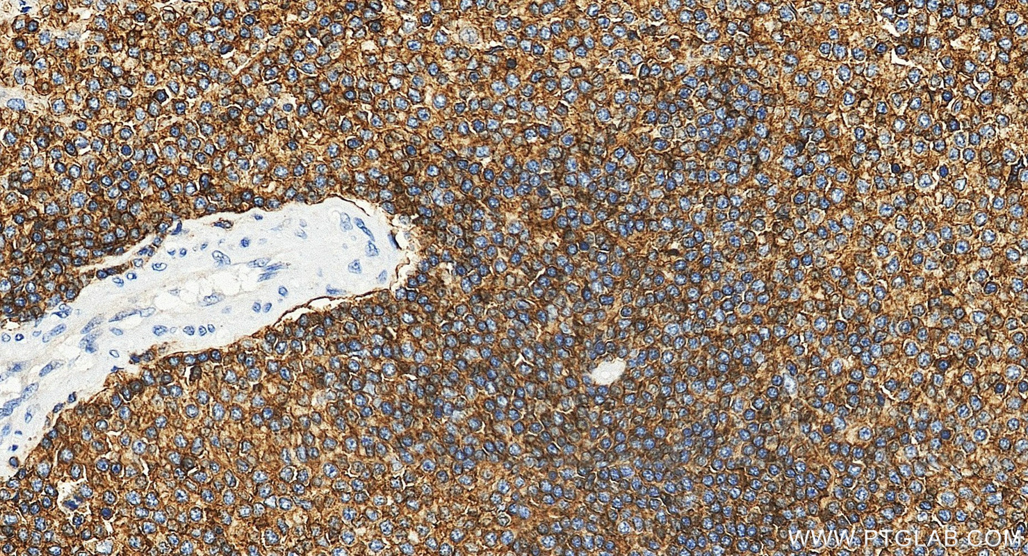 IHC staining of human spleen using 17699-1-AP (same clone as 17699-1-PBS)