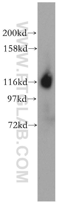 ICAM3 Polyclonal antibody