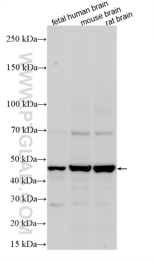 WB analysis using 11918-1-AP (same clone as 11918-1-PBS) WB analysis using 11918-1-AP (same clone as 11918-1-PBS)