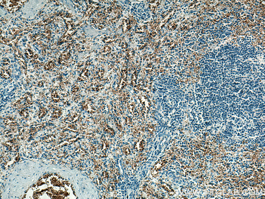 IHC staining of human spleen using 67014-1-Ig