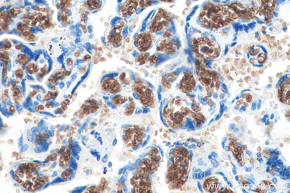 IHC staining of human placenta using 67014-1-Ig