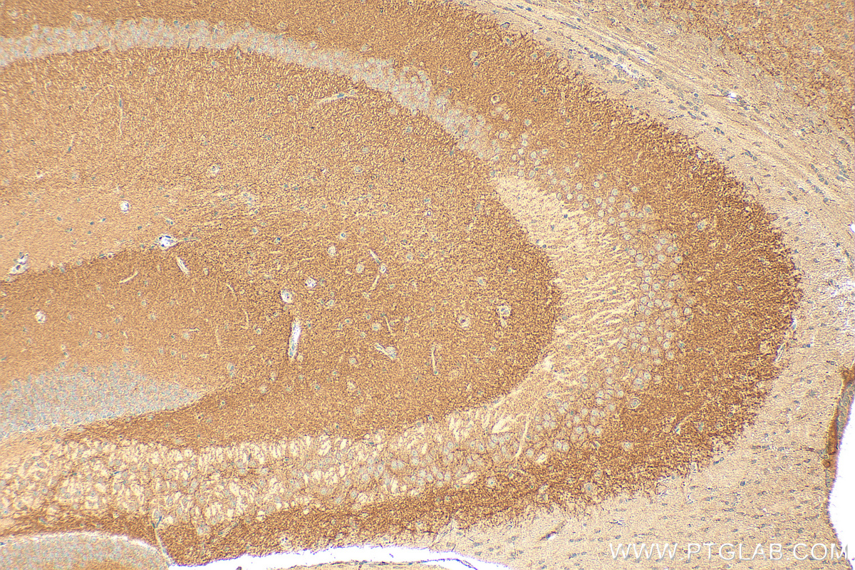 IHC staining of mouse brain using 12759-1-AP (same clone as 12759-1-PBS)