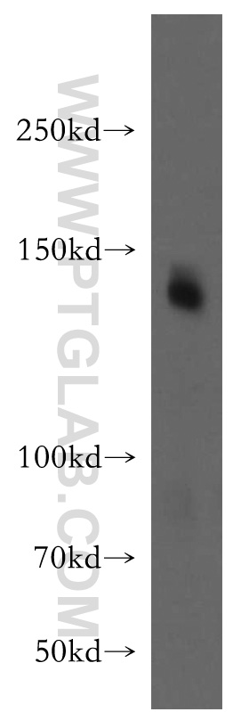 WB analysis of mouse brain using 12759-1-AP