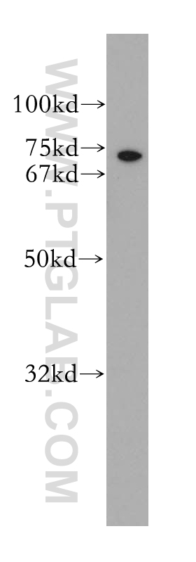 WB analysis of PC-3 using 13611-1-AP